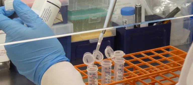 Scientist pipetting liquid into sample container