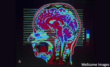 Brain Scan